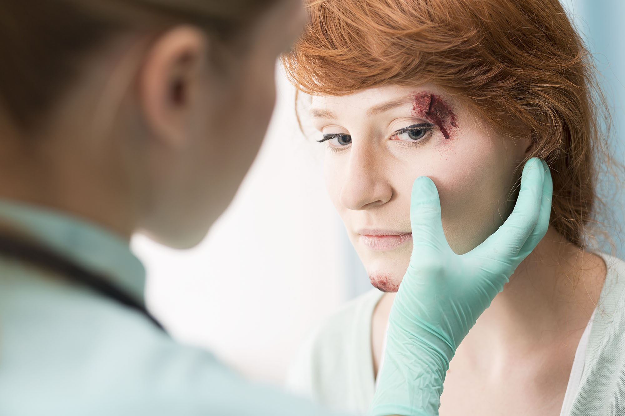 facial eye injury compensation claim solicitors Wakefield