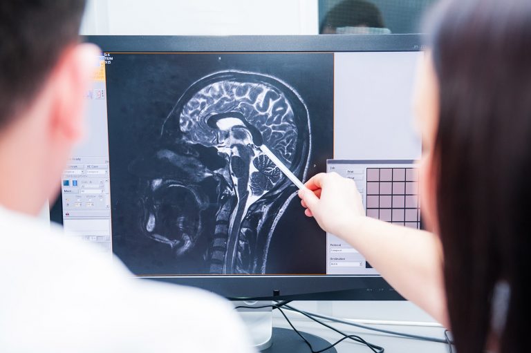 Doctors magnetic resonance image (MRI) injured brain, head injury solicitors Wakefield